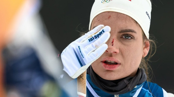 Норвежская лыжница упала и повредила лицо на Олимпийских играх